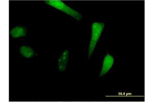 SIK1 antibody  (AA 1-100)