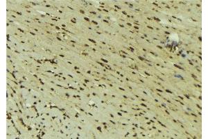 ABIN6277618 at 1/100 staining Mouse muscle tissue by IHC-P. (DNMT1 antibody  (Internal Region))
