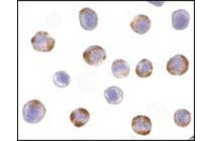 Immunocytochemistry of NOD2 in HeLa cells with this product at 10 μg/ml. (NOD2 antibody  (C-Term))