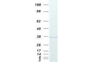 Validation with Western Blot (DNTTIP1 Protein (Myc-DYKDDDDK Tag))
