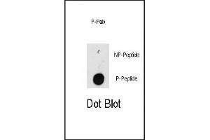 Dot blot analysis of anti-ILK-p Pab (R) on nitrocellulose membrane. (ILK antibody  (pThr173))