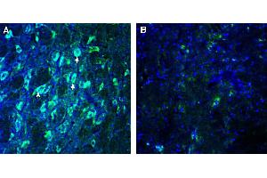 Expression of GPR108 in mouse red nucleus. (GPR108 antibody  (Extracellular))