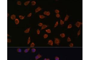 Immunofluorescence analysis of L929 cells using ACSS1 Polyclonal Antibody at dilution of 1:100. (ACSS1 antibody)