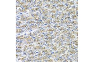 Immunohistochemistry of paraffin-embedded mouse stomach using STXBP2 antibody (ABIN5975753) at dilution of 1/100 (40x lens).