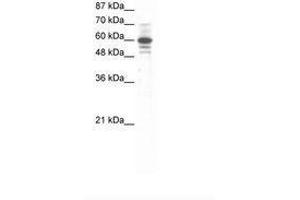 Image no. 1 for anti-Zinc Finger Protein 276 (ZNF276) (AA 284-333) antibody (ABIN6736062)