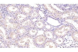 Detection of NT3 in Human Kidney Tissue using Monoclonal Antibody to Neurotrophin 3 (NT3) (Neurotrophin 3 antibody  (AA 130-255))