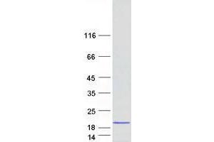 Western Blotting (WB) image for Ubiquitin-Conjugating Enzyme E2D 1 (UBE2D1) protein (Myc-DYKDDDDK Tag) (ABIN2734787)
