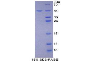 SDS-PAGE (SDS) image for Nischarin (NISCH) (AA 1335-1435) protein (His tag,GST tag) (ABIN1980701)