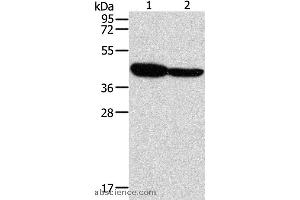 Western blot analysis of Mouse brain and Human fetal brain tissue, using GLRA1 Polyclonal Antibody at dilution of 1:500 (GLRA1 antibody)