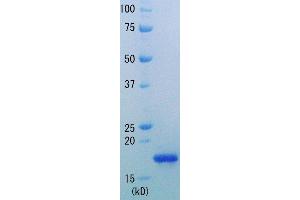 SDS-PAGE (SDS) image for Ribonuclease H (RNASEH) (Active) protein (ABIN3200996) (RNASEH Protein)