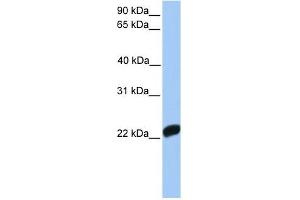 Factor X antibody used at 1 ug/ml to detect target protein. (Coagulation Factor X antibody  (C-Term))
