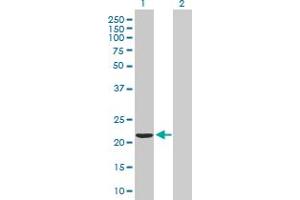 Western Blot analysis of VBP1 expression in transfected 293T cell line by VBP1 MaxPab polyclonal antibody. (VBP1 antibody  (AA 1-197))
