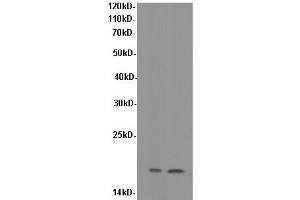 Western Blotting (WB) image for anti-Superoxide Dismutase 1, Soluble (SOD1) antibody (ABIN5958578) (SOD1 antibody)
