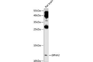 Western blot analysis of extracts of rat brain, using GPH antibody (ABIN6132023, ABIN6141322, ABIN6141323 and ABIN6214909) at 1:1000 dilution. (GPHa2 antibody  (AA 24-129))