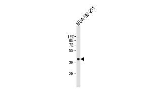Anti-CYR61 Antibody (Center) at 1:2000 dilution + MDA-MB-231 whole cell lysate Lysates/proteins at 20 μg per lane. (CYR61 antibody  (AA 143-174))