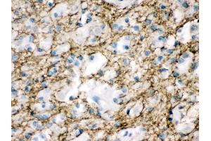Anti- Munc18-1 Picoband antibody, IHC(P) IHC(P): Human Glioma Tissue (STXBP1 antibody  (N-Term))