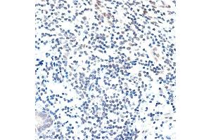 Immunohistochemistry of paraffin-embedded human appendix using P Rabbit mAb (ABIN7269152) at dilution of 1:100 (40x lens). (PAF1/PD2 antibody)