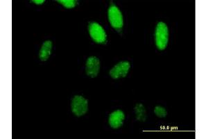 Immunofluorescence of purified MaxPab antibody to TCEA2 on HeLa cell.