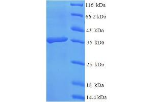 SDS-PAGE (SDS) image for C-Type Lectin Domain Family 4, Member D (CLEC4D) (AA 39-215) protein (His-SUMO Tag) (ABIN5711597)