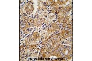 Image no. 1 for anti-Transient Receptor Potential Cation Channel, Subfamily M, Member 8 (TRPM8) (C-Term) antibody (ABIN360717) (TRPM8 antibody  (C-Term))