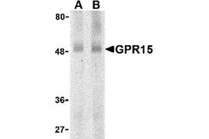 Western Blotting (WB) image for anti-G Protein-Coupled Receptor 15 (GPR15) (N-Term) antibody (ABIN1031395) (GPR15 antibody  (N-Term))