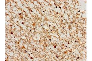 Immunohistochemistry of paraffin-embedded human brain tissue using ABIN7148834 at dilution of 1:100 (Cyclin A1 antibody  (AA 1-152))