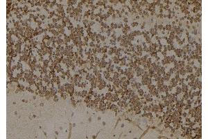 ABIN6276817 at 1/100 staining Mouse brain tissue by IHC-P. (AKR1B1 antibody  (C-Term))