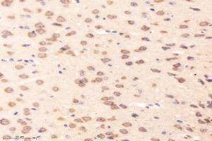 Immunohistochemistry analysis of paraffin-embedded mouse striatum using,RRAGB (ABIN7075379) at dilution of 1: 4000 (RRAGB antibody)
