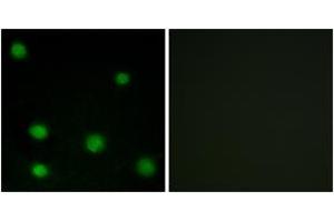 Immunofluorescence analysis of COS7 cells, using RBM6 Antibody. (RBM6 antibody  (AA 991-1040))