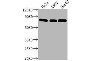 Western Blot Positive WB detected in: Hela whole cell lysate, K562 whole cell lysate, HepG2 whole cell lysate All lanes HSPA8 antibody at 1:2000 Secondary Goat polyclonal to mouse IgG at 1/50000 dilution Predicted band size: 70~75 KDa Observed band size: 70~75 KDa Exposure time: 5 min (Hsc70 antibody  (AA 2-646))