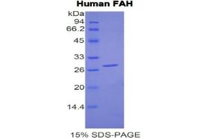 SDS-PAGE (SDS) image for Fumarylacetoacetate Hydrolase (Fumarylacetoacetase) (FAH) ELISA Kit (ABIN6574328)