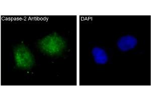 Immunofluorescent analysis of Hela cells, using Caspase-2 Antibody. (Recombinant Caspase 2 antibody)