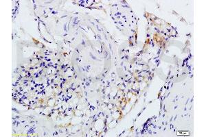 Formalin-fixed and paraffin embedded rat colitis tissue labeled with Anti-IL-1R1 CD121a IL1 Receptor I Polyclonal Antibody, unconjugated (ABIN747743) at 1:200 followed by incubation with conjugated secondary antibody and DAB staining (IL1R1 antibody  (AA 481-569))