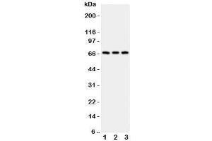 Western blot testing of CD30 antibody and Lane 1:  HeLa;  2: 293T;  3: Jurkat;  Predicted molecular weight: 53-120 kDa depending on glycosylation level. (TNFRSF8 antibody  (AA 322-595))