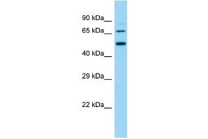 Host:  Rabbit  Target Name:  Slc9a8  Sample Type:  Rat Small Intestine lysates  Antibody Dilution:  1. (NHE8 antibody  (N-Term))