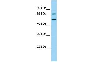 Host:  Rabbit  Target Name:  Slc9a8  Sample Type:  Rat Small Intestine lysates  Antibody Dilution:  1.