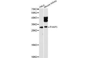 Western blot analysis of extracts of various cell lines, using THAP3 antibody (ABIN6293620) at 1:1000 dilution.