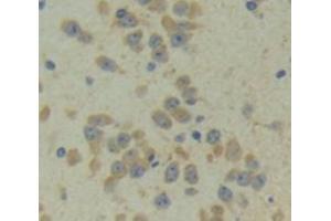 Used in DAB staining on fromalin fixed paraffin- embedded Kidney tissue (CITED1 antibody  (AA 1-203))