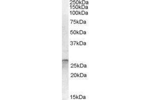 Western Blotting (WB) image for OTU Domain, Ubiquitin Aldehyde Binding 2 (OTUB2) peptide (ABIN370056) (OTU Domain, Ubiquitin Aldehyde Binding 2 (OTUB2) Peptide)