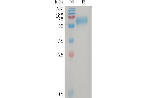 GPR56 Protein (AA 26-402) (His tag)