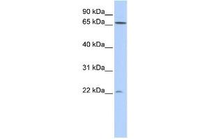 Western Blotting (WB) image for anti-DIRAS Family, GTP-Binding RAS-Like 1 (DIRAS1) antibody (ABIN2459582) (DIRAS1 antibody)