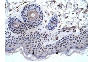 ZNF660 antibody was used for immunohistochemistry at a concentration of 4-8 ug/ml to stain Squamous epithelial cells (arrows) in Human Skin. (ZNF660 antibody  (C-Term))