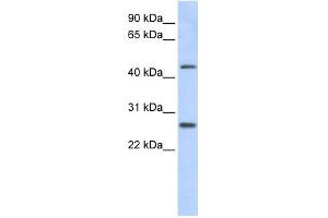 PRAMEF10 antibody used at 1 ug/ml to detect target protein. (PRAMEF10 antibody  (Middle Region))