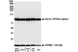 Western Blotting (WB) image for anti-alpha 1 Sodium Potassium Atpase antibody (ABIN7455086) (alpha 1 Sodium Potassium Atpase antibody)