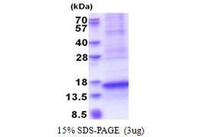 SDS-PAGE (SDS) image for Chemokine (C-X-C Motif) Ligand 17 (CXCL17) (AA 22-119) protein (His tag) (ABIN5853587)