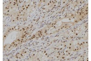 ABIN6279360 at 1/100 staining Human kidney tissue by IHC-P. (POLD4 antibody  (Internal Region))