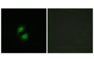 Immunofluorescence analysis of A549 cells, using ZNF95 antibody. (ZKSCAN5 antibody)
