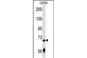 SLC27A3 Antibody (N-term) (ABIN657380 and ABIN2846425) western blot analysis in CEM cell line lysates (35 μg/lane). (SLC27A3 antibody  (N-Term))