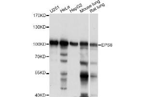Western blot analysis of extracts of various cell lines, using EPS8 antibody (ABIN6291700) at 1:1000 dilution.
