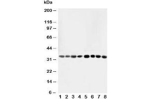 Western blot testing of AIMP2 antibody and Lane 1:  rat liver;  2: rat lung;  3: rat kidney;  4: rat brain;  5: Jurkat;  6: CEM;  7: HUT;  8: U93T;  10: U93T cell lysate
